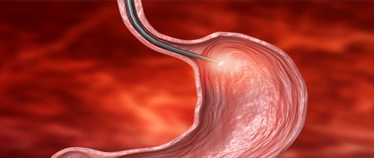Endoscopia Gastrointestinal