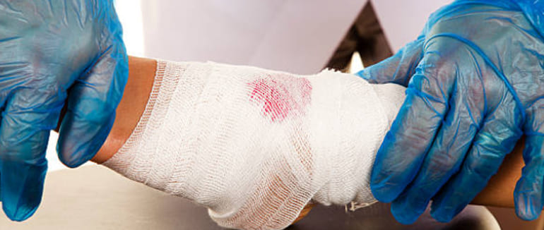 Tratamiento de heridas crónicas o infectadas