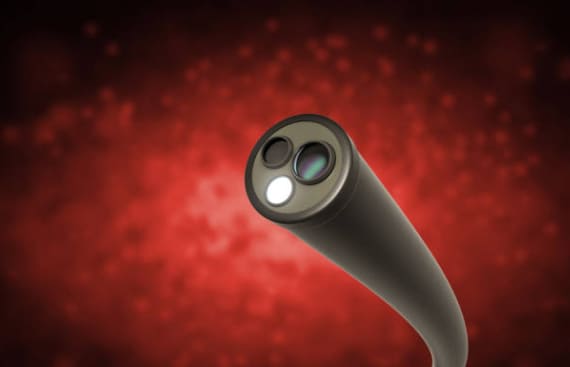 Costos de una endoscopia