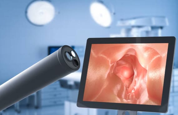 Endoscopia gastrointestinal