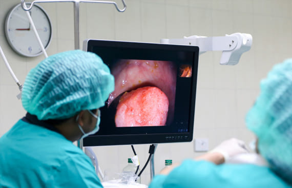 Endoscopia