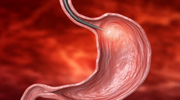 Endoscopia Gastrointestinal