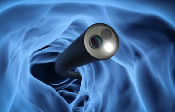 Precio de endoscopia