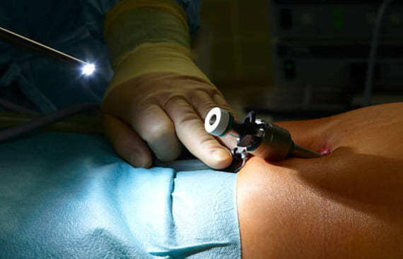 Precio endoscopia